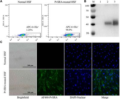 Identification of the Recombinant Plasmodium vivax Surface-Related Antigen as a Possible Immune Evasion Factor Against Human Splenic Fibroblasts by Targeting ITGB1